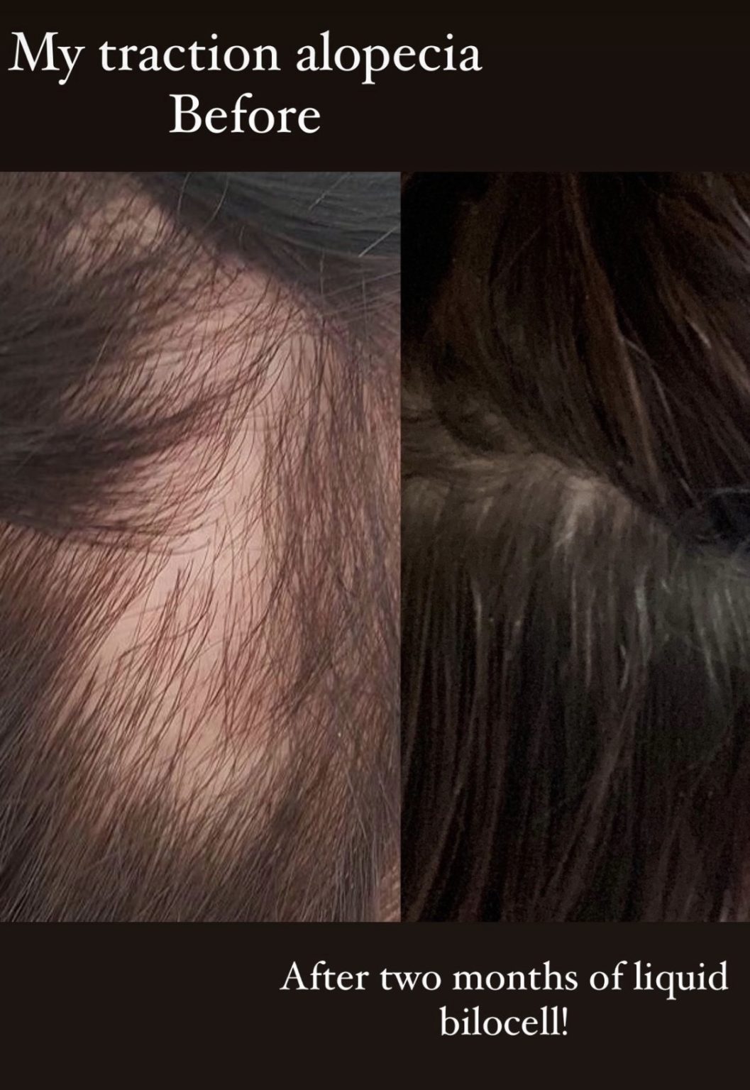 Liquid Collagen you need for hair growth and dewy skin Lunchpails and